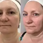 Пилинг «Элексир молодости»